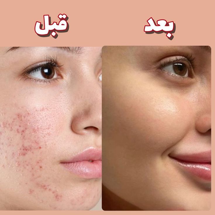 رضایت مشتری